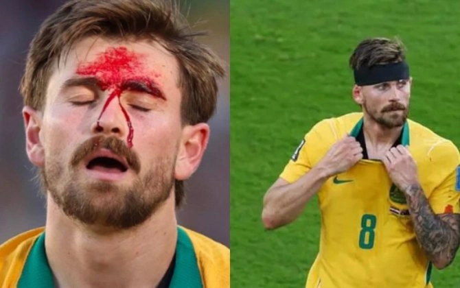 Alnına buts dəysə də, sarğı ilə oyuna geri döndü - FOTO