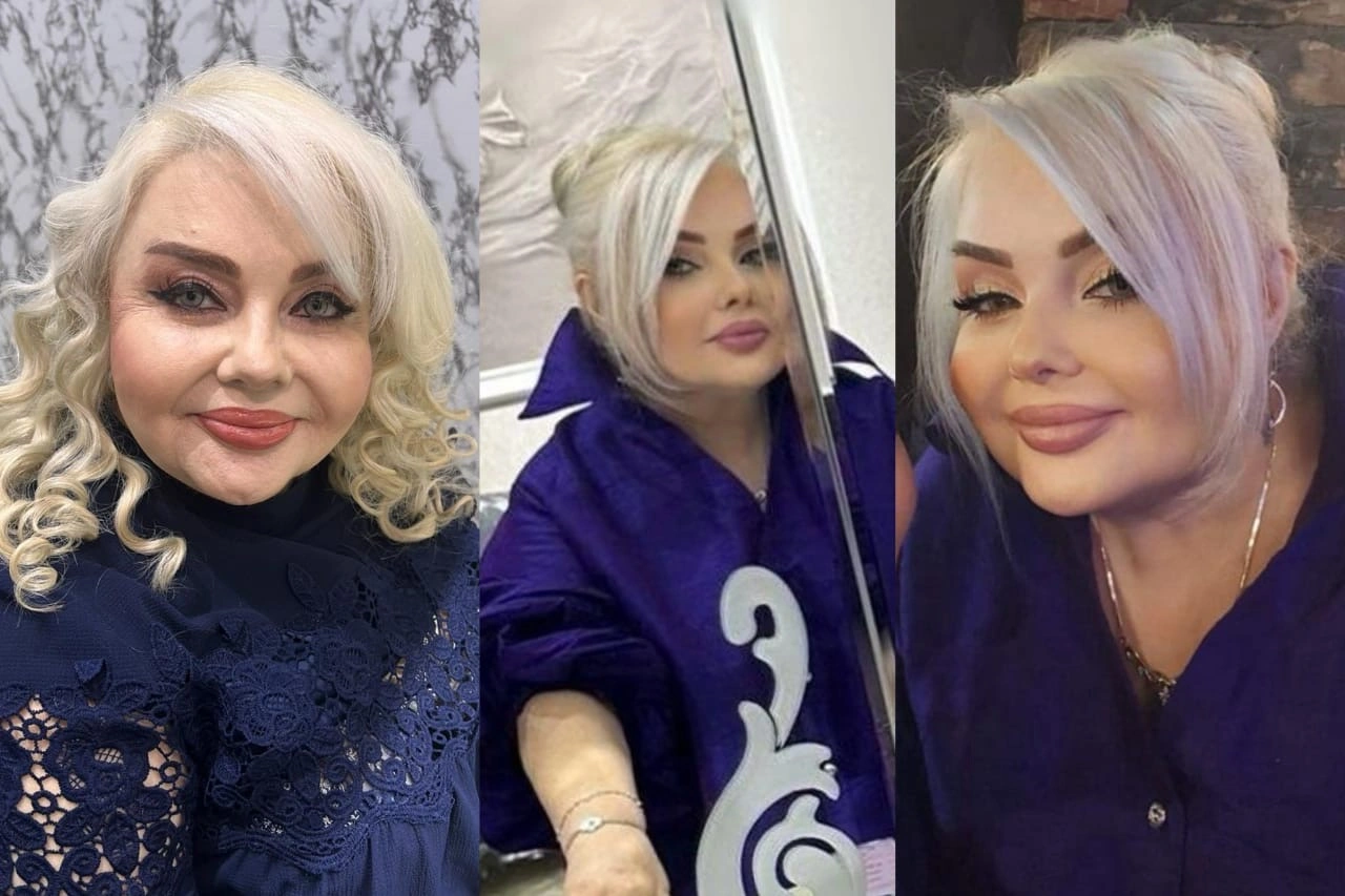 “Ya məni “öldürür”lər, ya deyirlər vəziyyəti ağırdır, paxıl, başdanxarab insanlardır” - FOTO+ÖZƏL