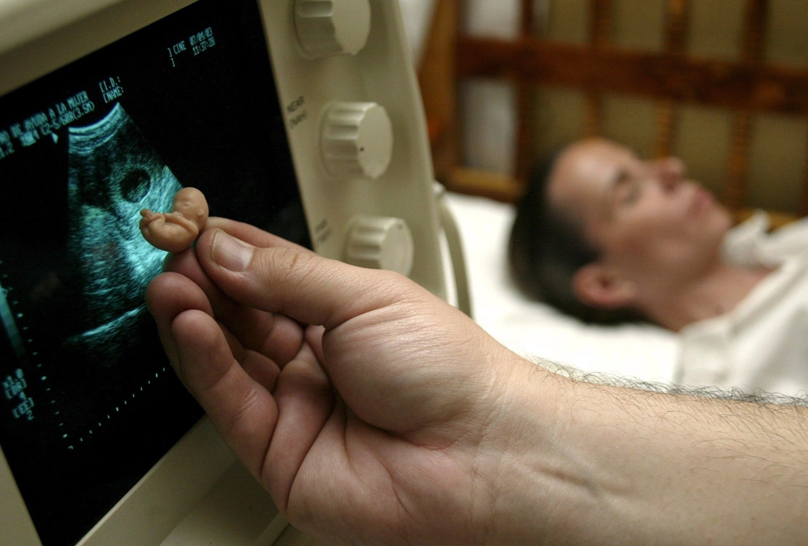 Ölkədə abortların sayı sürətlə artır - TƏHLÜKƏ