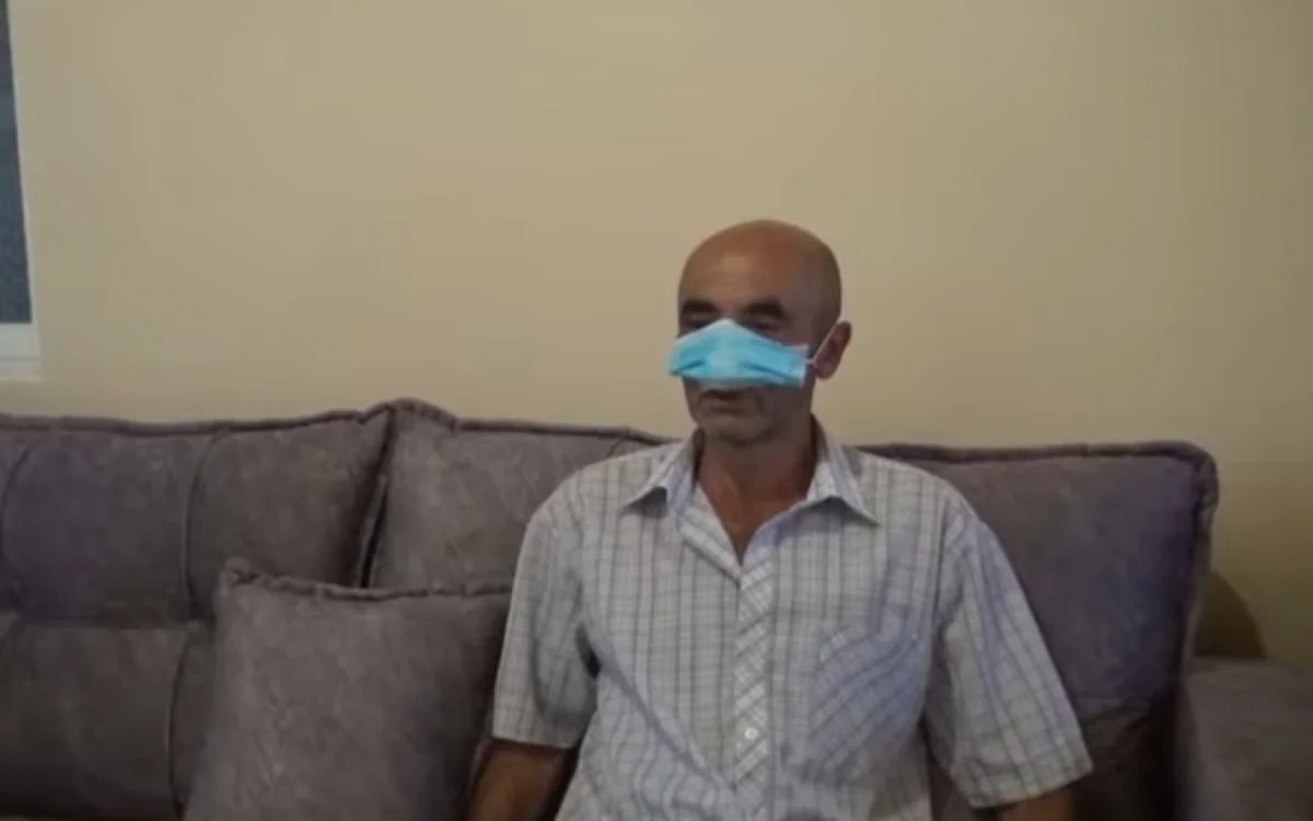 İt burnunu dişlədi, müalicə olunmasa çürüyəcək - VİDEO
