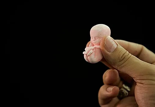 Ölkədə abortların sayı sürətlə artır - TƏHLÜKƏ
