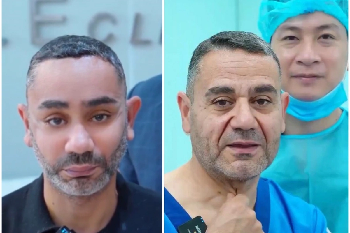 58 yaşlı kişi gəncləşmək üçün Viyetnama getdi, tanınmaz hala düşdü