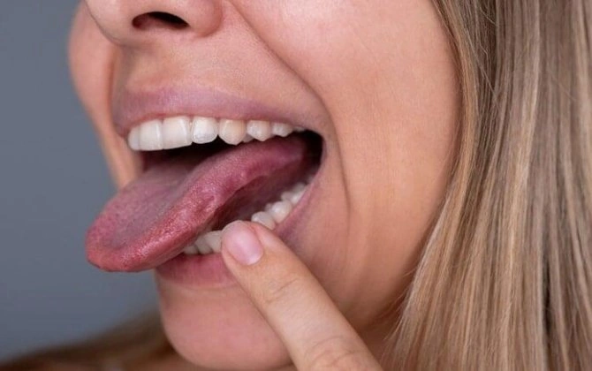 Niyə dilimizi təsadüfən dişləyəndə ağrıyır, amma bilərəkdən dişləyəndə yox?