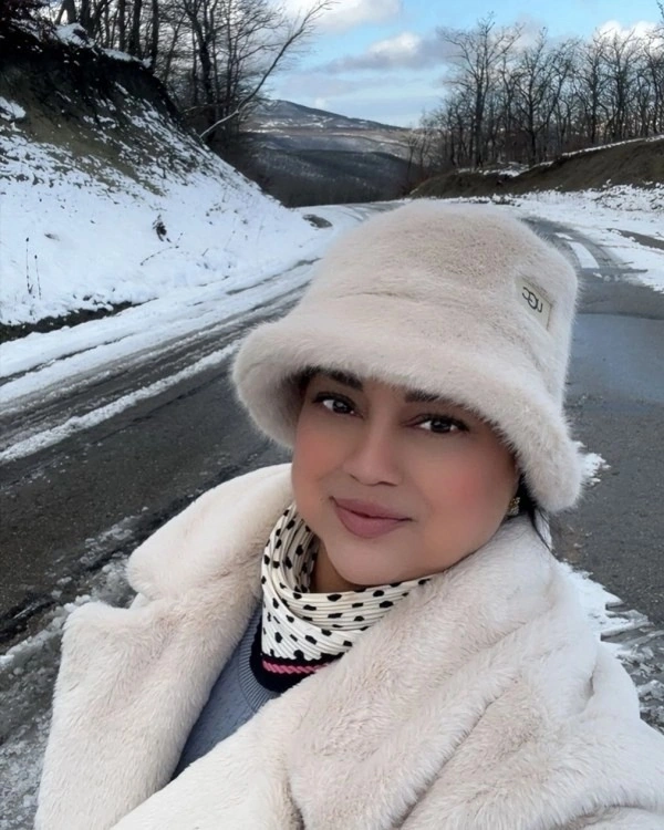 Xalq artisti tanınmaz halda - FOTO