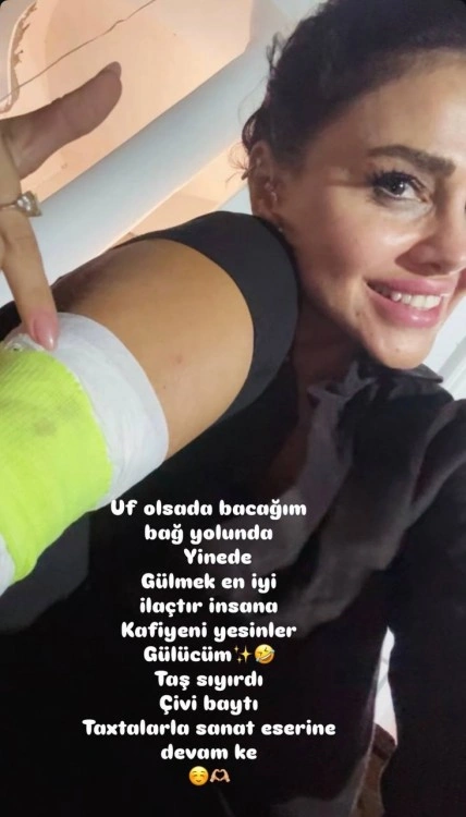 Günelin başına iş gəldi - FOTO