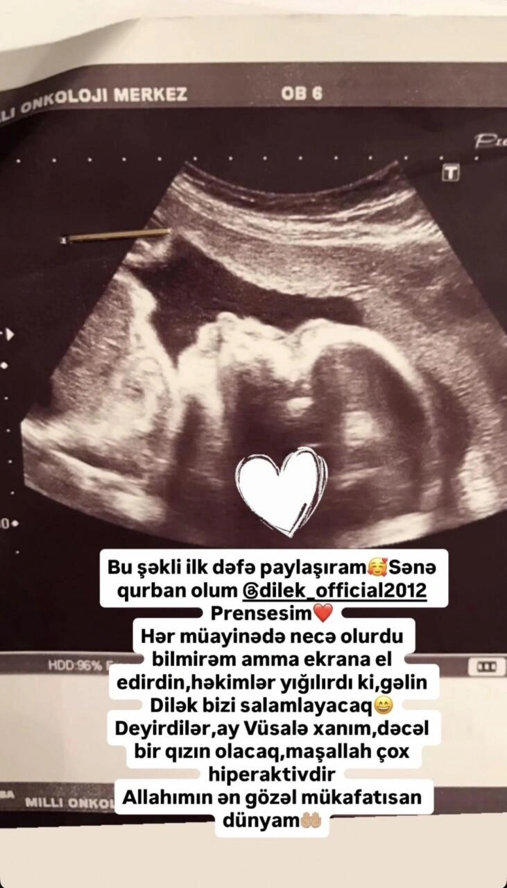 "Bu FOTOnu ilk dəfədir paylaşıram"