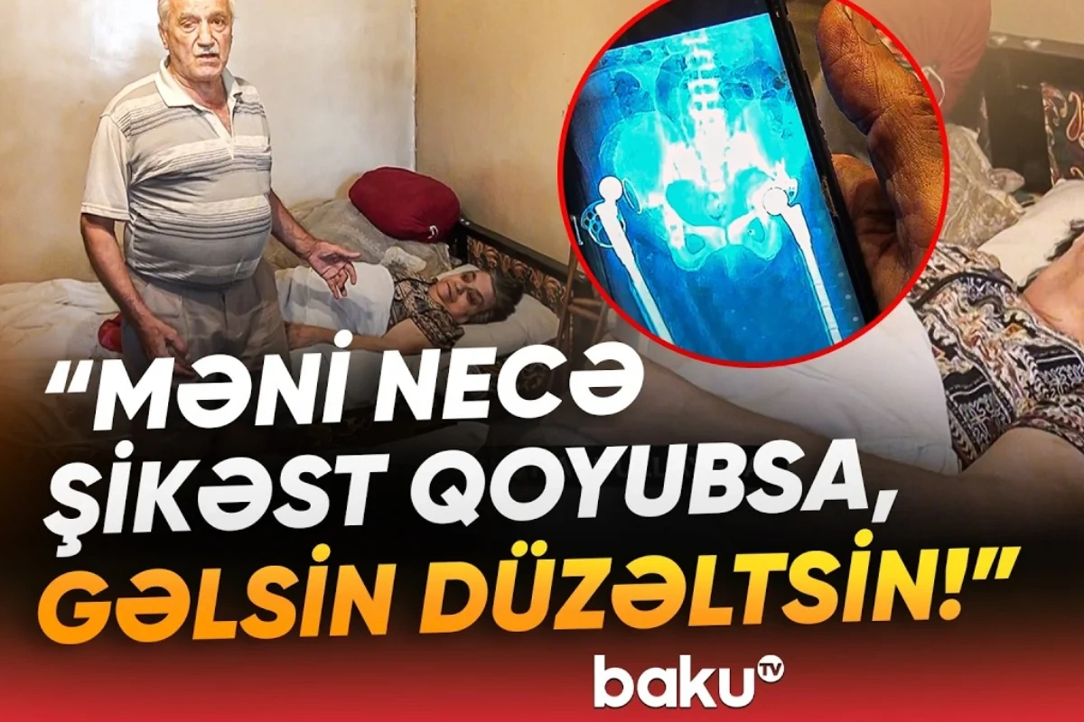 Qadının sol ayağının yerinə sağ ayağı əməliyyat edilib? - "Həkim dedi ki, qayıtmayacağam" - VİDEO