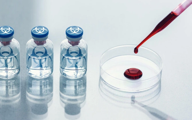 ABŞ Milli Kəşfiyyatı indiyə qədər gizlədilən bioloji laboratoriyaların sayını açıqladı