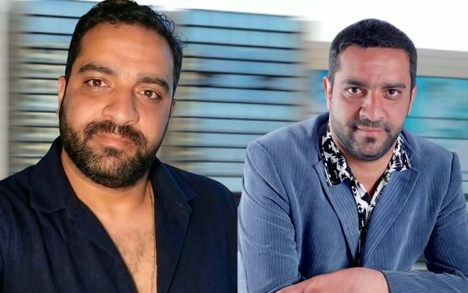 Tanınmış aktyorda ağır xəstəlik aşkarlanıb:  “10 il əvvəl də başımdakı şişdən əməliyyat olunmuşdum” - FOTO