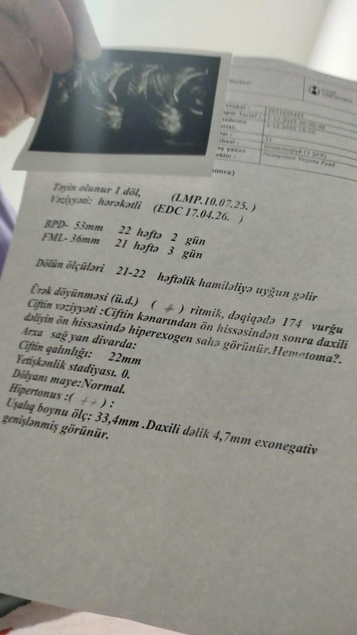 “5 aylıq övladımı Sabunçu xəstəxanasında tələf etdilər”