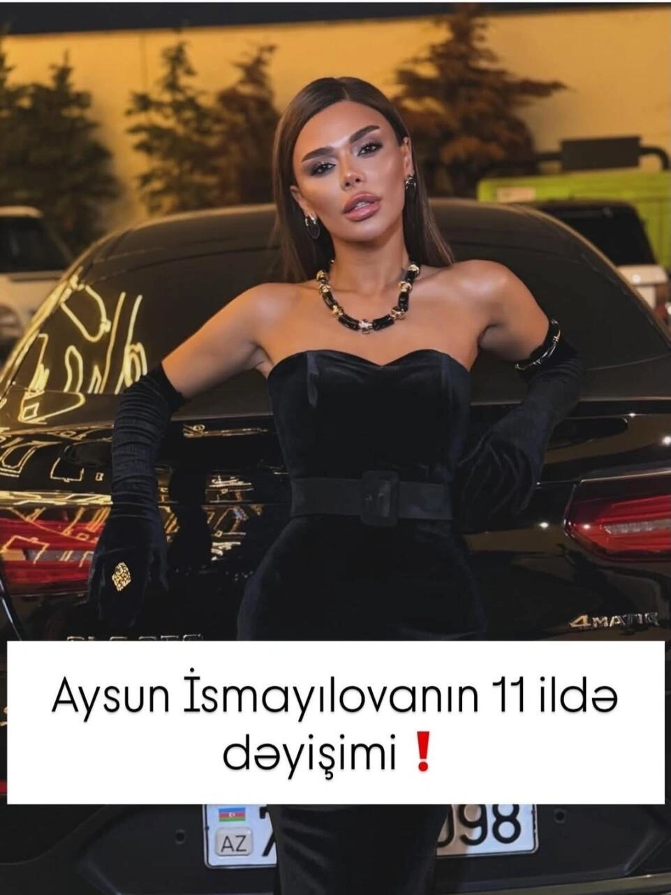Aysunun 11 ildə görünüşündəki dəyişikliklər DİQQƏT ÇƏKDİ - FOTO