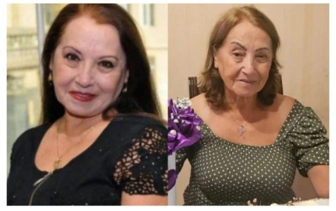“Rejissor dedi ki, belə qız ola bilməz, gözləri oynayır”-FOTOLAR