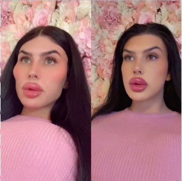 "Britaniyada ən böyük dodaqlara sahib qadın görünüşünü dəyişməyə qərar verib" - "LadBible"