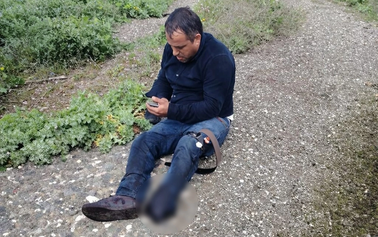 Ağdamda minaya düşən Ceyhunun - Fotosu