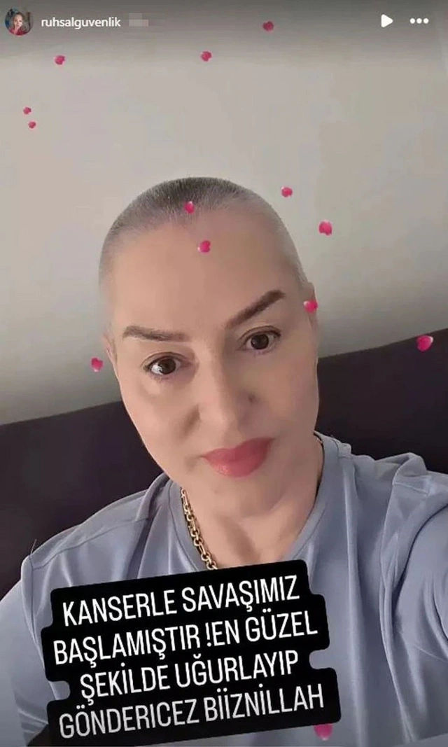 Kurtlar Vadisinin aktrisası vəfat etdi - FOTO
