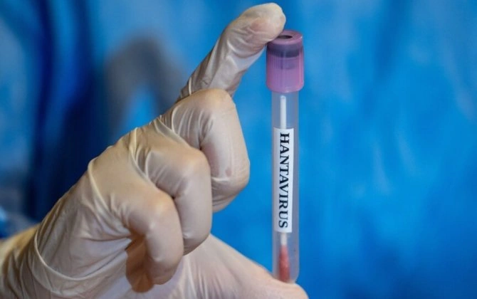 Hantavirus aşkarlanan gəmidən təxliyə edilən Türkiyə vətəndaşlarının test nəticələri neqativ çıxıb