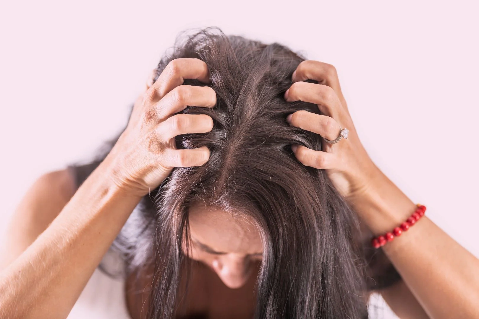 Niyə stress saç tökülməsinə səbəb olur və nə etmək lazımdır?