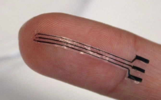"Mühəndislər dərmansız təzyiqi 15 faiz azaldan 3D implant hazırlayıb" - Yeni tədqiqat